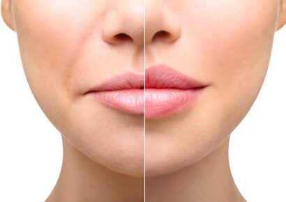 Complications and side effects: A detailed analysis of anti-wrinkle treatments